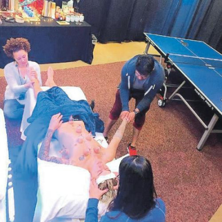 今年3月，有网民在网上晒出加拿大歌手贾斯汀·比伯接受拔罐治疗的照片。
