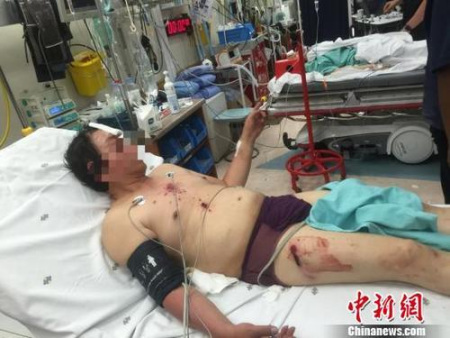 来自广西柳州的受伤男子。钟欣 摄