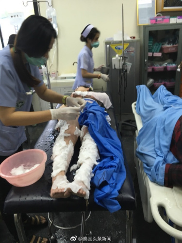 泰国皮皮岛附近一快艇突发爆炸,多名中国人受伤(图:泰国头条新闻微博) 泰国皮皮岛附近一快艇突发爆炸,多名中国人受伤(图:泰国头条新闻微博)