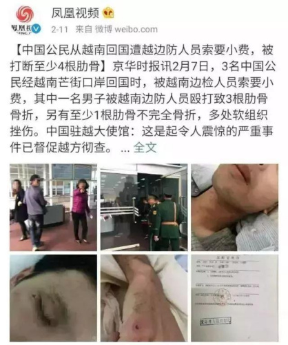 中国公民被越南边检人员索要小费不成被殴打致骨折 新闻来源：凤凰视频