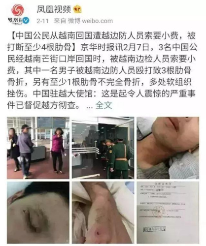 中国公民被越南边检人员索要小费不成被殴打致骨折 新闻来源:凤凰视频 中国公民被越南边检人员索要小费不成被殴打致骨折 新闻来源:凤凰视频