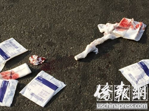 东百老汇139号好炒手中式快餐馆门外发生吃“霸王餐”并打伤店主事件,地上遗下血迹。(美国《侨报》/叶永康