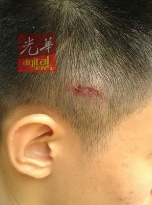 (马来西亚《光华日报》图片)