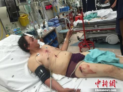 中国侨网来自广西柳州的受伤男子。钟欣 摄