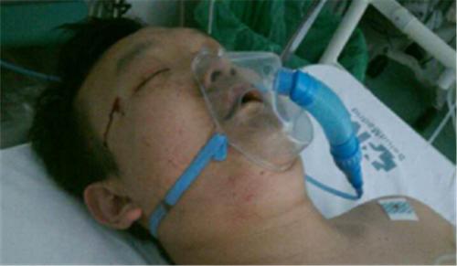 中国侨网图为被殴打成重伤的华人男子,目前仍在医院中接受治疗。(西班牙欧浪网图片)