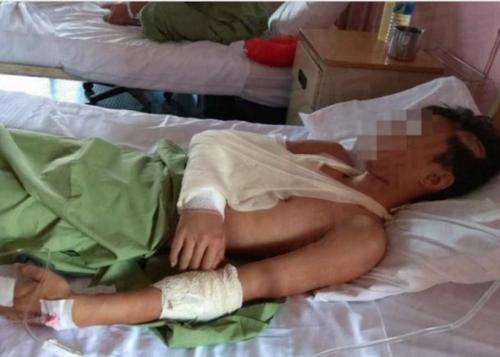 中国侨网男生被围殴致重伤。 