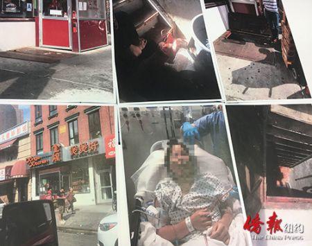 中国侨网陈秀贞手术图片以及事发现场图片。(美国《侨报》/伤者提供 张晶翻拍)