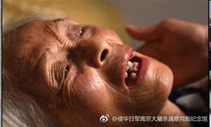 中国侨网病卧在床的顾秀兰。图片来源：侵华日军南京大屠杀遇难同胞纪念馆官方微博 。