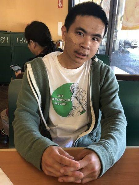 中国侨网苏柏诠与往常一样外出抽烟,不料却在家门口遇上抢犯,不仅手机、钱包被抢,还被歹徒暴打,身心受创。(美国《世界日报》/林亚歆 摄)