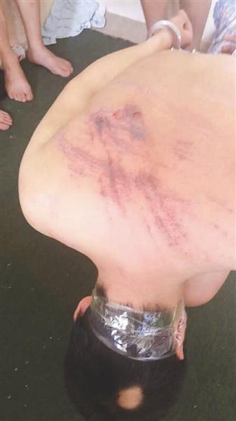 中国侨网家人手机上的照片显示，唐坤背部全是伤痕