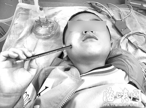 晋江一8岁男孩教室里被同学撞 铅笔插进脸颊