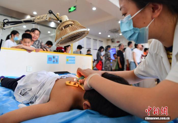 7月20日，福建中医药大学国医堂医务人员为一位小朋友进行三伏体质灸。当日是入伏首日，福州民众前往医疗机构接受冬病夏治“三伏灸”，通过穴位艾灸、贴敷疗法等防病治病。中新社记者 张斌 摄