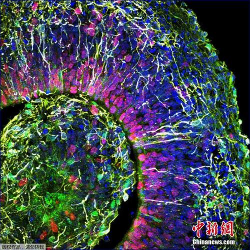 美科学家首次在培育的“微型大脑”中发现电信号