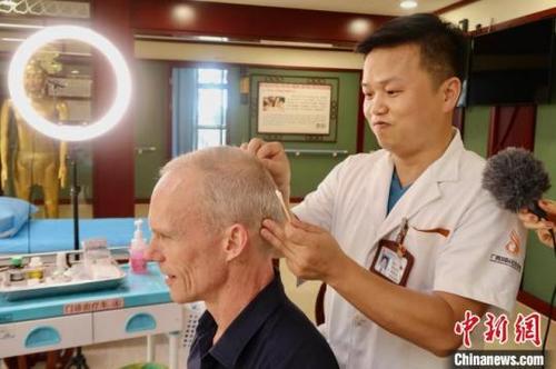 中国侨网图为外国专家体验壮医针灸疗法。黄树显摄